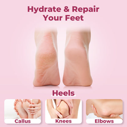 40% Urea Foot Cream