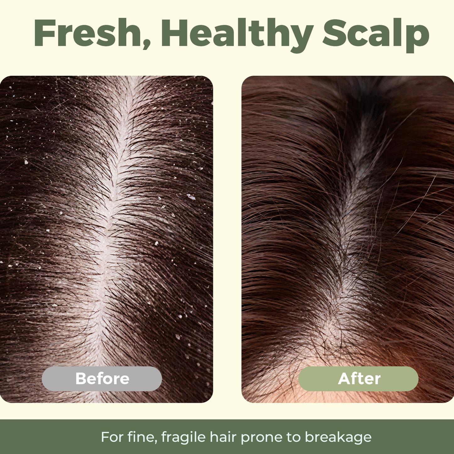 Tea Tree & Mint Shampoo & Conditioner Soap Set