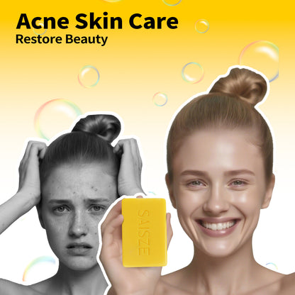 Natural Sulfur Soap Bar