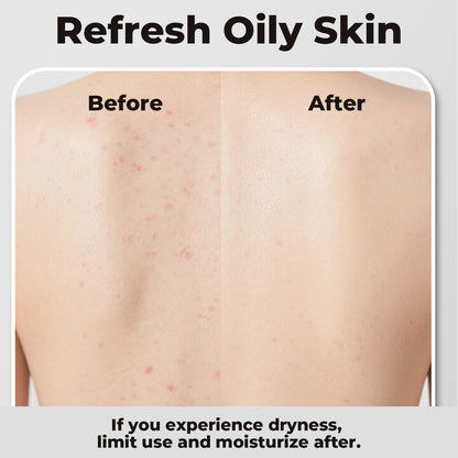 Activated Charcoal Soap Bar