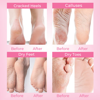 Foot Peel Mask