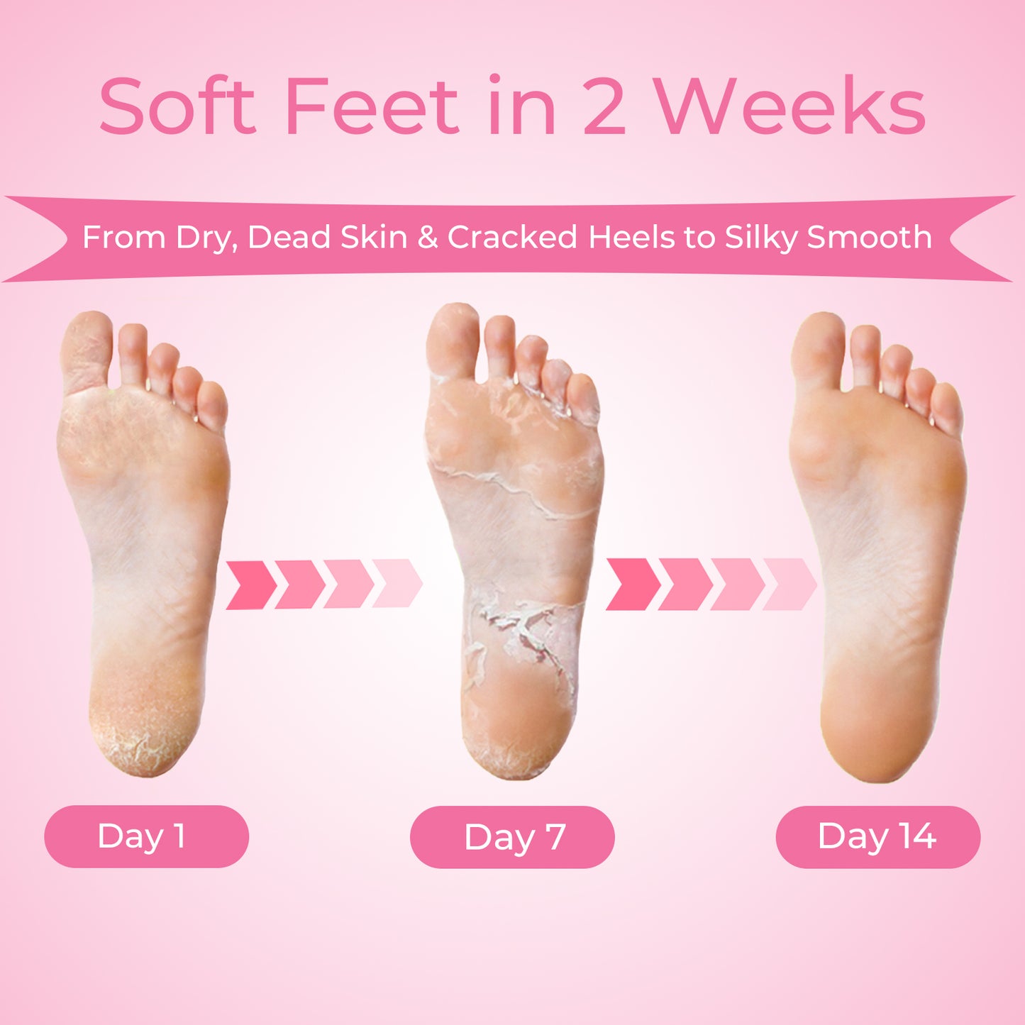 Foot Peel Mask