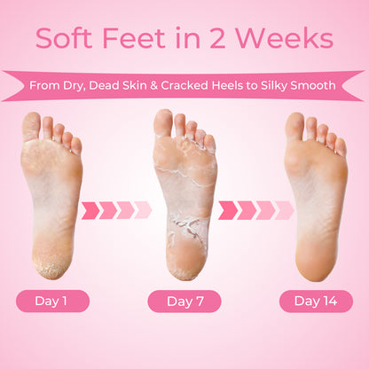 Foot Peel Mask