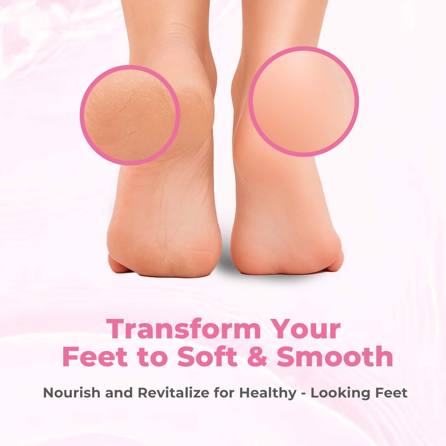 Callus Remover Gel for Feet
