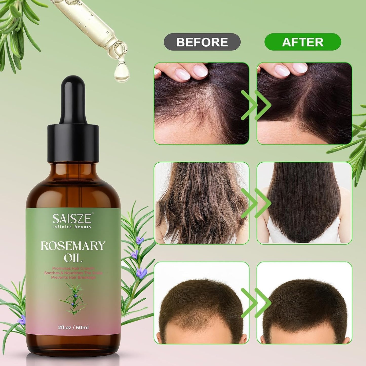 Rosemary Oil for Hair Growth